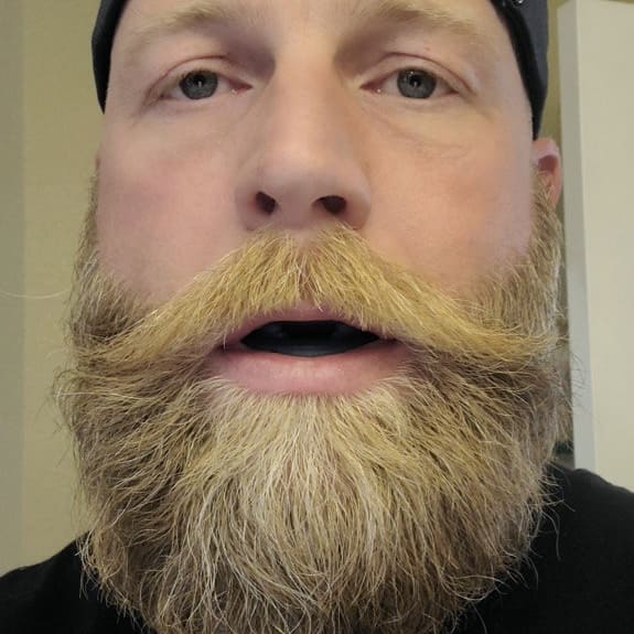 SENIUM™ – Bite anti-russamento silenzioso universale