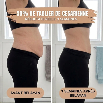 Slip post-partum — Compressione a 360°